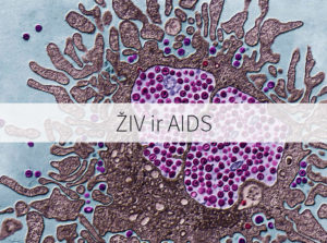 ŽIV ir AIDS