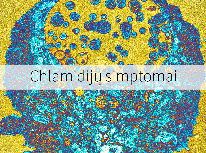 Chlamidijų simptomai