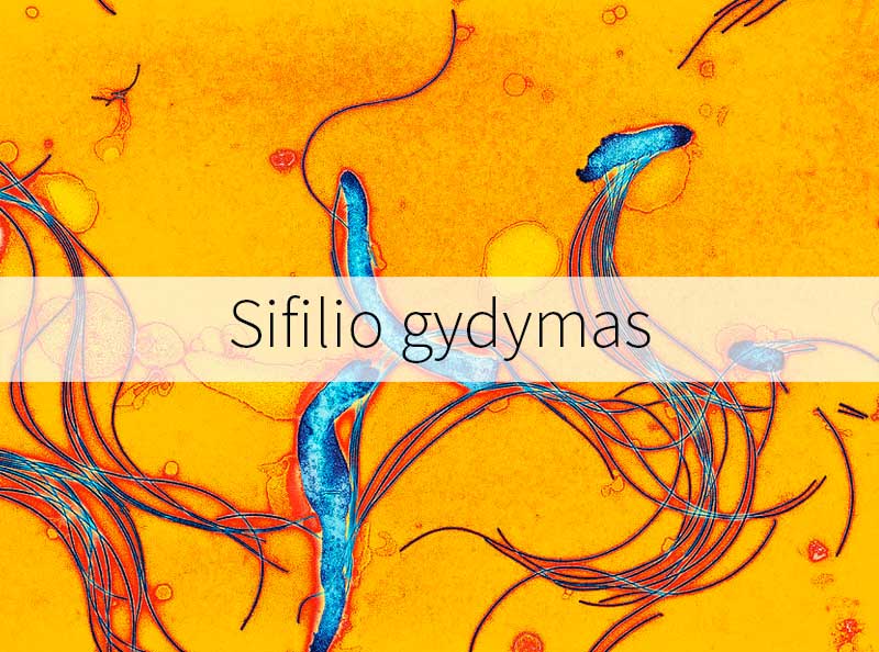 Sifilio gydymas