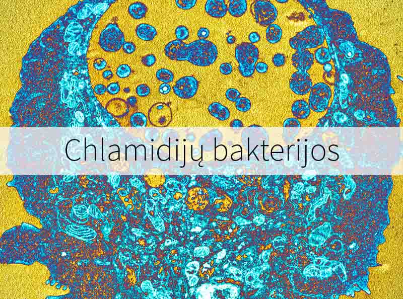 Chlamidijų bakterijos