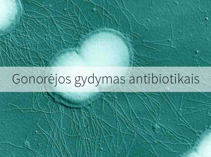 Gonorėjos gydymas antibiotikais