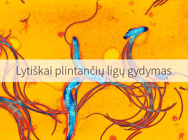 Lytiškai plintančių ligų gydymas